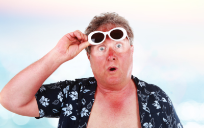 Don’t Get Burned! Quick Tips for Sun Safety This Summer